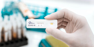 Detenida en Málaga una organización que vendía test de antígenos sin cumplir las normas sanitarias