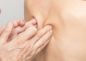 Los beneficios de la fisioterapia en la recuperación de pacientes ingresados por Covid-19