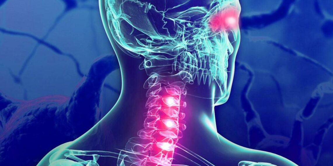 Un estudio señala al «virus de la enfermedad del beso» como causa de la Esclerosis Múltiple