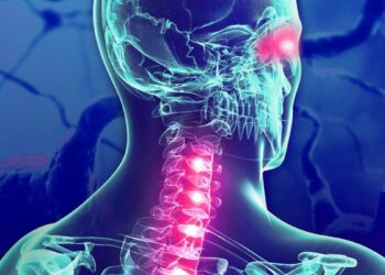 Un estudio señala al «virus de la enfermedad del beso» como causa de la Esclerosis Múltiple