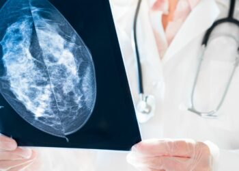 El nuevo fármaco que frena la metástasis en el cáncer de mama