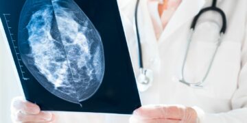 El nuevo fármaco que frena la metástasis en el cáncer de mama