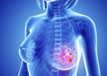 Un fármaco consigue frenar un cáncer de mama muy agresivo en el 75% de las pacientes