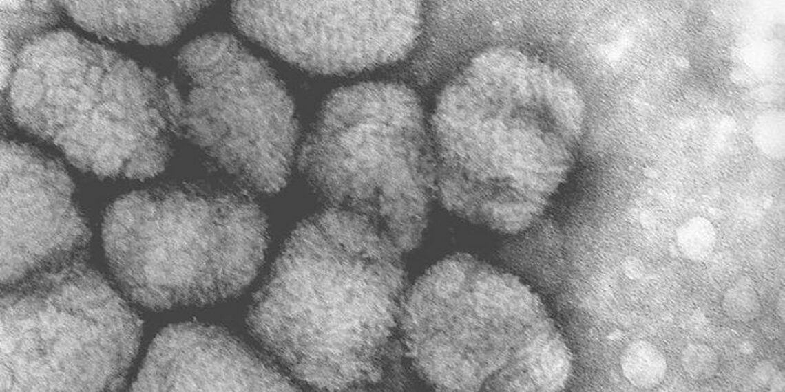 Sanidad confirma la segunda muerte por viruela del mono en España