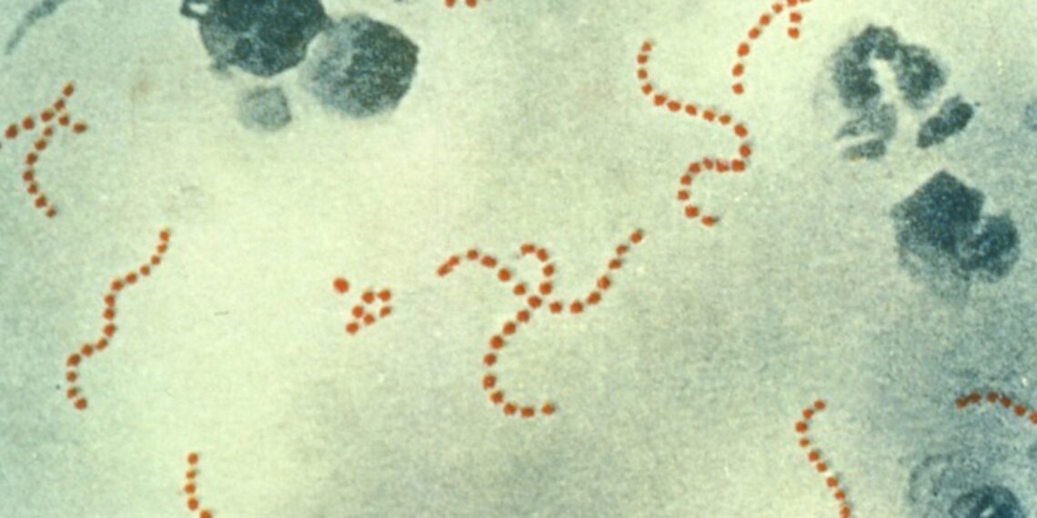 Confirmados cinco menores ingresados en Andalucía por estreptococo del grupo A, uno de ellos en UCI