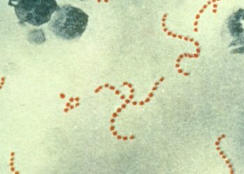 Confirmados cinco menores ingresados en Andalucía por estreptococo del grupo A, uno de ellos en UCI