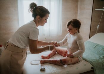 Las familias con hijos con Piel de Mariposa: «Lo más difícil es verlos sufrir cada día»