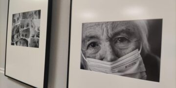 Mijas visibiliza la enfermedad del Alzheimer a través de la fotografía