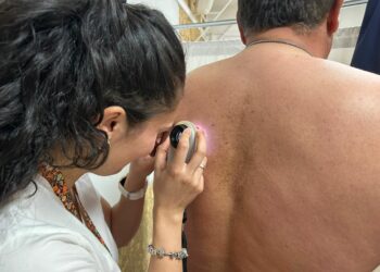 El servicio de Dermatología del Hospital Universitario Costa del Sol detectó un melanoma cada dos días en 2023