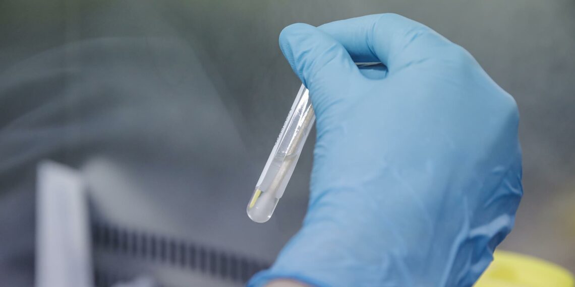 Sanidad reúne este martes a las comunidades para analizar la emergencia sanitaria de la viruela del mono