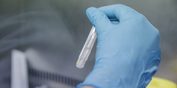 Sanidad reúne este martes a las comunidades para analizar la emergencia sanitaria de la viruela del mono