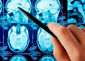 Crean unos nanorrobots que podrían ayudar a curar los aneurismas cerebrales