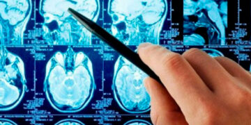 Crean unos nanorrobots que podrían ayudar a curar los aneurismas cerebrales