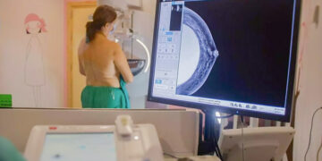 El SAS realiza este año la reconstrucción de mama tras una operación por cáncer a 1.470 mujeres