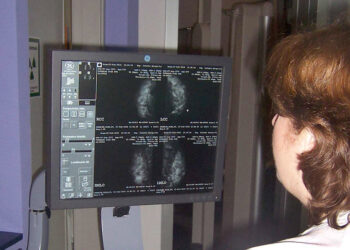 El cáncer de mama centra la mayor parte de las investigaciones oncológicas que se realizan en la sanidad pública