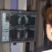 El cáncer de mama centra la mayor parte de las investigaciones oncológicas que se realizan en la sanidad pública