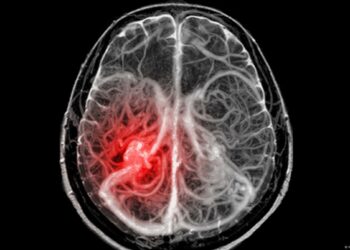 Logran tratar con éxito cánceres cerebrales infantiles incurables
