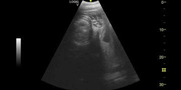 Una ecografía que da esperanza: la cría de tapir malayo del Bioparc Fuengirola avanza «perfectamente»