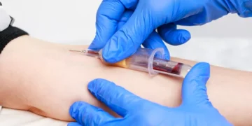 Un innovador análisis de sangre mejora la detección precoz del Alzheimer con una precisión del 80%