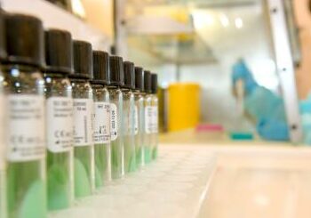 La Junta declara cerrado el brote de sarampión de la guardería de Fuengirola