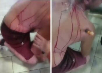 Apuñalamiento en Mijas: un destornillador incrustado en el hombro de la víctima