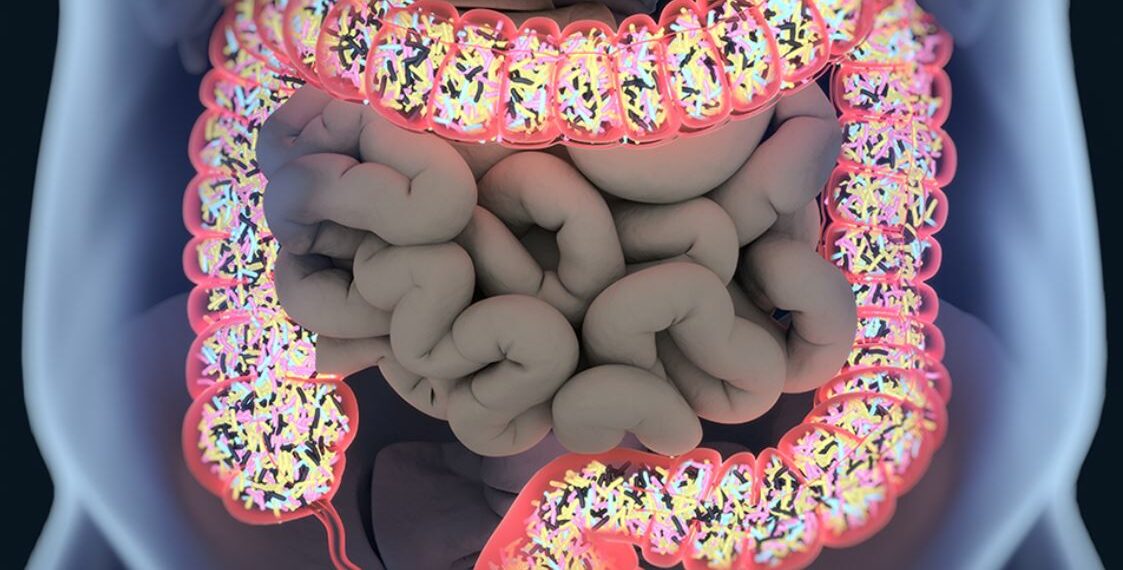La microbiota intestinal, clave en la relación entre obesidad y cáncer colorrectal