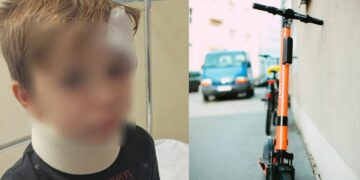 La abuela del niño atropellado por un patinete en Manilva: «Creía que me lo habían matado»