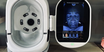 Conoce el diagnóstico facial 3D que triunfa en la Costa del Sol de la mano de Nirvana