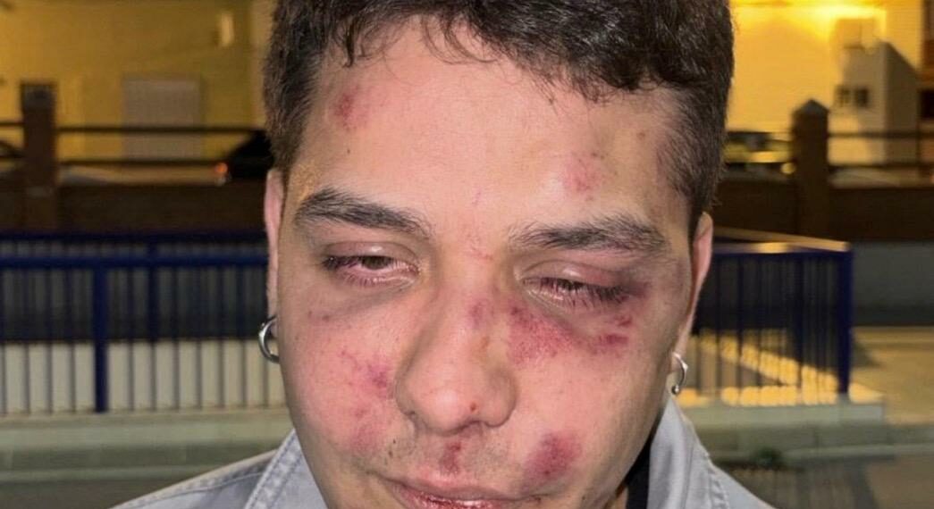 Brutal agresión a un joven en Málaga por ser «antifascista»
