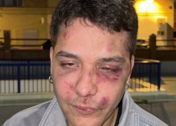 Brutal agresión a un joven en Málaga por ser «antifascista»