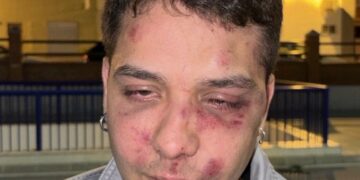 Brutal agresión a un joven en Málaga por ser «antifascista»