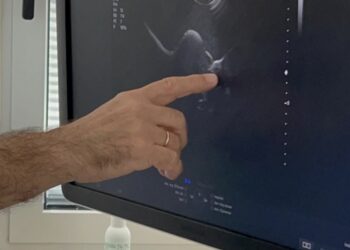 El Regional de Málaga forma a profesionales en una técnica avanzada para el estudio de infertilidad