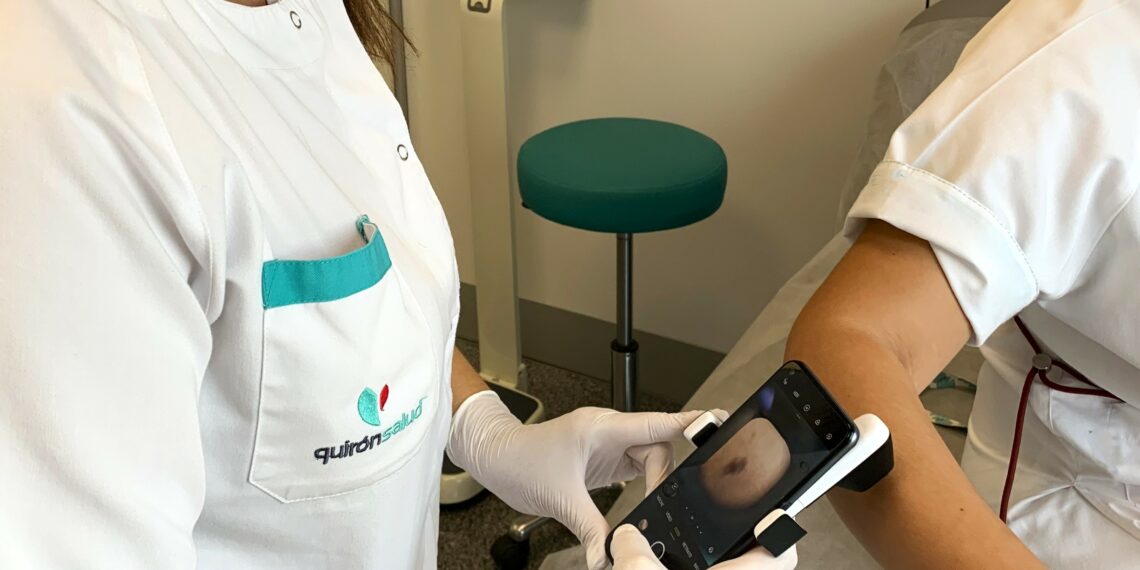 La detección precoz y la protección solar son los mejores escudos para salvar vidas frente al cáncer de piel