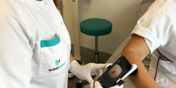 La detección precoz y la protección solar son los mejores escudos para salvar vidas frente al cáncer de piel